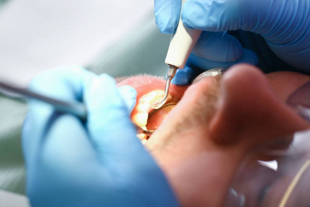 Best Emergency Dental Care for Broken or Chipped Teeth in Mosheim, TN